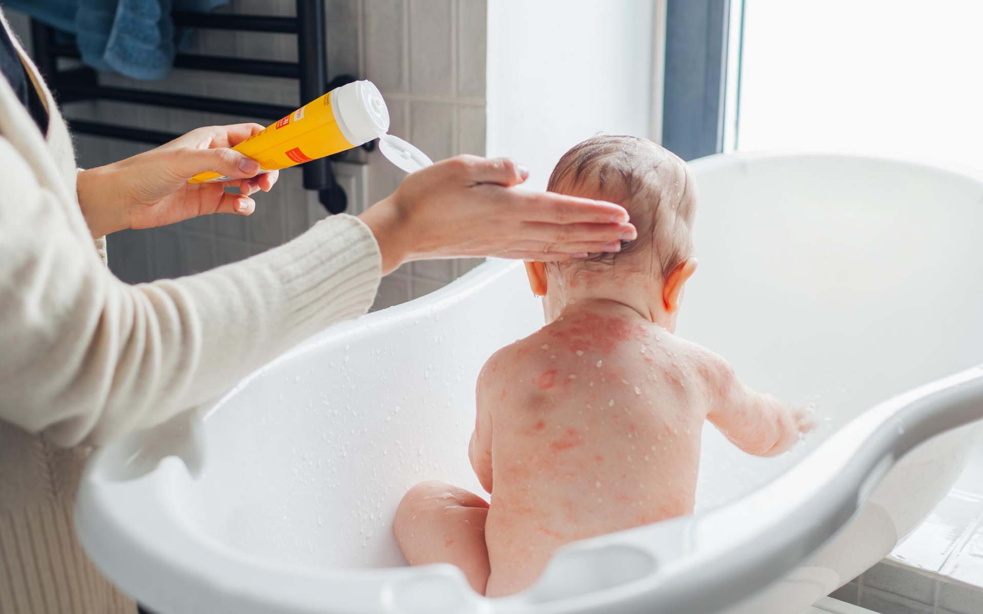Does filtered tap water help with eczema symptoms? A family guide